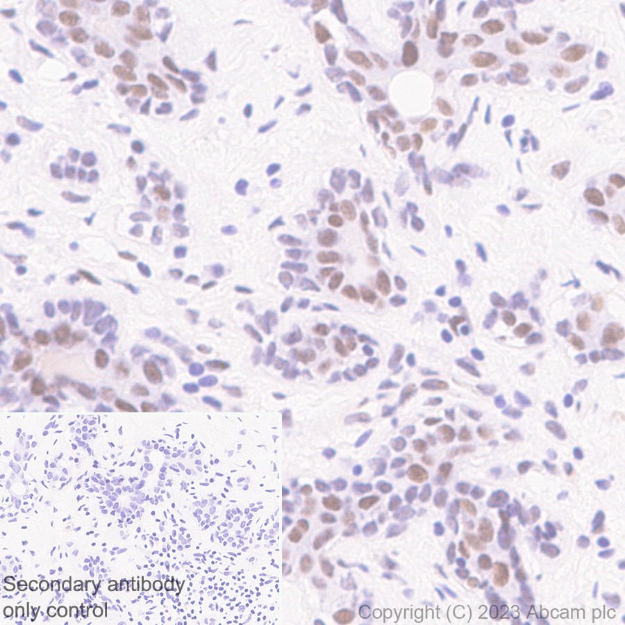 Immunohistochemistry (Formalin/PFA-fixed paraffin-embedded sections) - Anti-CTNNBL1 antibody [EP2669Y] (AB76243)