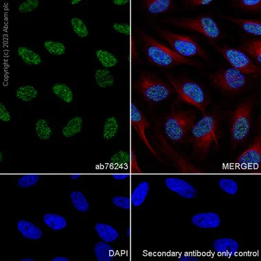 Immunocytochemistry - Anti-CTNNBL1 antibody [EP2669Y] - BSA and Azide free (AB284752)