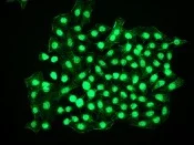 Immunocytochemistry/ Immunofluorescence - Anti-CTNNBL1 antibody [EP2669Y] - BSA and Azide free (AB284752)