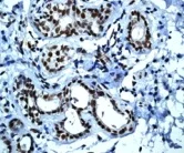 Immunohistochemistry (Formalin/PFA-fixed paraffin-embedded sections) - Anti-CTNNBL1 antibody [EP2669Y] - BSA and Azide free (AB284752)