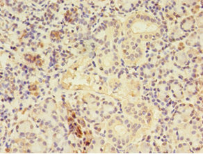 Immunohistochemistry (Formalin/PFA-fixed paraffin-embedded sections) - Anti-CTP synthase/CTPS antibody (AB235000)