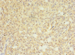 Immunohistochemistry (Formalin/PFA-fixed paraffin-embedded sections) - Anti-CTP synthase/CTPS antibody (AB235000)