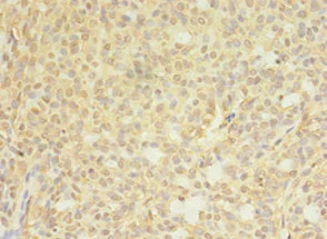 Immunohistochemistry (Formalin/PFA-fixed paraffin-embedded sections) - Anti-CTP synthase/CTPS antibody (AB235000)