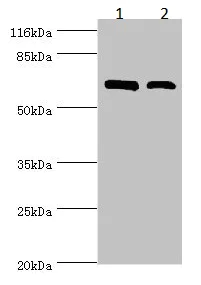 Western blot - Anti-CTP synthase/CTPS antibody (AB235000)