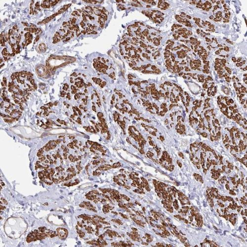 Immunohistochemistry (Formalin/PFA-fixed paraffin-embedded sections) - Anti-CTP synthase/CTPS antibody (AB244492), expandable thumbnail