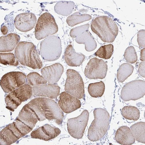Immunohistochemistry (Formalin/PFA-fixed paraffin-embedded sections) - Anti-CTP synthase/CTPS antibody (AB244492), expandable thumbnail