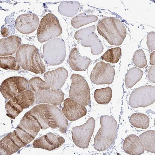 Immunohistochemistry (Formalin/PFA-fixed paraffin-embedded sections) - Anti-CTP synthase/CTPS antibody (AB244492)