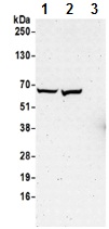 Western blot - Anti-CTPS2 antibody - C-terminal (AB190462)
