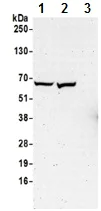 Western blot - Anti-CTPS2 antibody - C-terminal (AB190462)