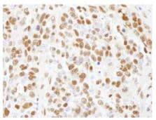 Immunohistochemistry (Formalin/PFA-fixed paraffin-embedded sections) - Anti-CTR9 antibody (AB84487)