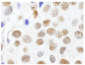 Immunohistochemistry (Formalin/PFA-fixed paraffin-embedded sections) - Anti-CTR9 antibody (AB84487)