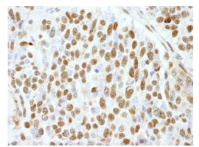Immunohistochemistry (Formalin/PFA-fixed paraffin-embedded sections) - Anti-CTR9 antibody (AB84487), expandable thumbnail
