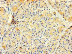 Immunohistochemistry (Formalin/PFA-fixed paraffin-embedded sections) - Anti-CTRB1 antibody (AB235053)