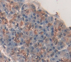 Immunohistochemistry (Formalin/PFA-fixed paraffin-embedded sections) - Anti-CTRB2 antibody (AB231284)