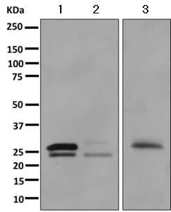 Western blot - Anti-CTRL antibody [EPR11490(B)] (AB157219)
