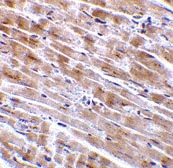Immunohistochemistry (Formalin/PFA-fixed paraffin-embedded sections) - Anti-CTRP3 antibody (AB36870), expandable thumbnail