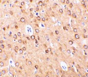 Immunohistochemistry (Formalin/PFA-fixed paraffin-embedded sections) - Anti-CTRP4 antibody (AB36871)
