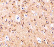 Immunohistochemistry (Formalin/PFA-fixed paraffin-embedded sections) - Anti-CTRP4 antibody (AB36871)