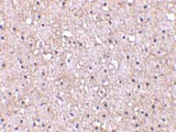 Immunohistochemistry (Formalin/PFA-fixed paraffin-embedded sections) - Anti-CTRP5 antibody (AB36893)