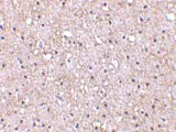 Immunohistochemistry (Formalin/PFA-fixed paraffin-embedded sections) - Anti-CTRP5 antibody (AB36893)