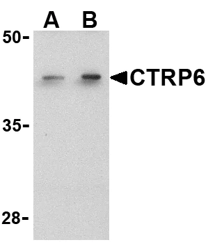 Western blot - Anti-CTRP6 antibody (AB36898)
