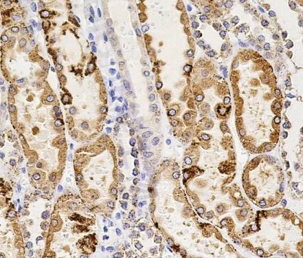 Immunohistochemistry (Formalin/PFA-fixed paraffin-embedded sections) - Anti-CTSL + CTSV + CTSK + CTSH antibody [SR1633] (AB326685)