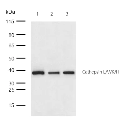 Western blot - Anti-CTSL + CTSV + CTSK + CTSH antibody [SR1633] (AB326685)