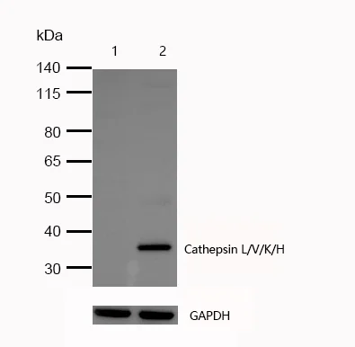 Western blot - Anti-CTSL + CTSV + CTSK + CTSH antibody [SR1633] (AB326685)