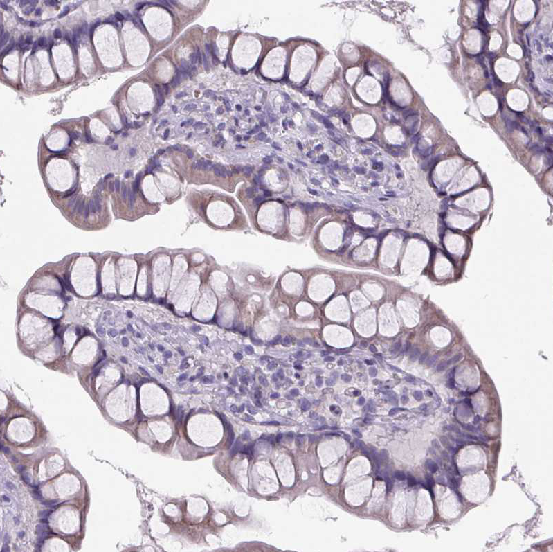 Immunohistochemistry (Formalin/PFA-fixed paraffin-embedded sections) - Anti-Cubilin antibody (AB244274), expandable thumbnail
