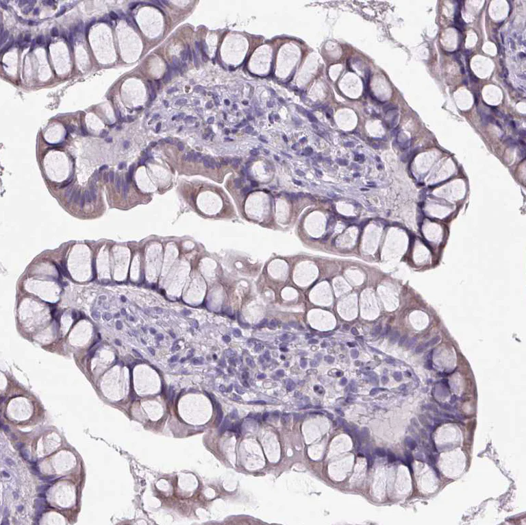 Immunohistochemistry (Formalin/PFA-fixed paraffin-embedded sections) - Anti-Cubilin antibody (AB244274)