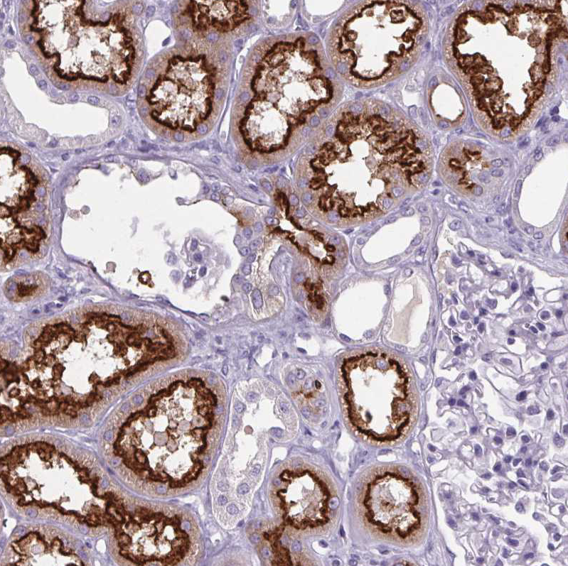 Immunohistochemistry (Formalin/PFA-fixed paraffin-embedded sections) - Anti-Cubilin antibody (AB244274), expandable thumbnail