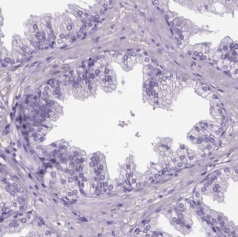 Immunohistochemistry (Formalin/PFA-fixed paraffin-embedded sections) - Anti-Cubilin antibody (AB244274), expandable thumbnail