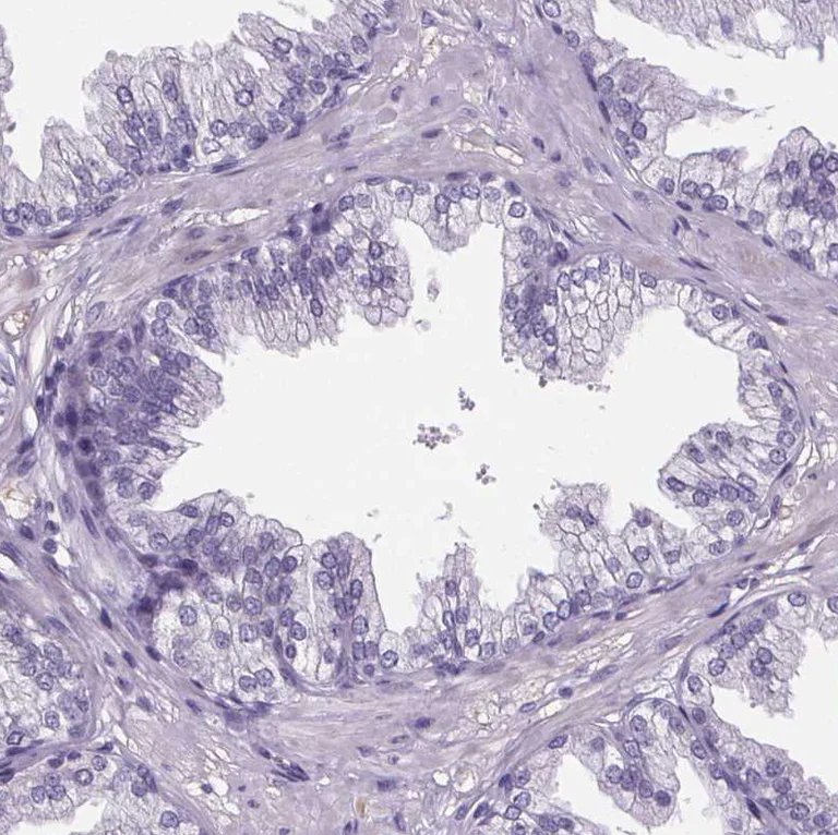 Immunohistochemistry (Formalin/PFA-fixed paraffin-embedded sections) - Anti-Cubilin antibody (AB244274)