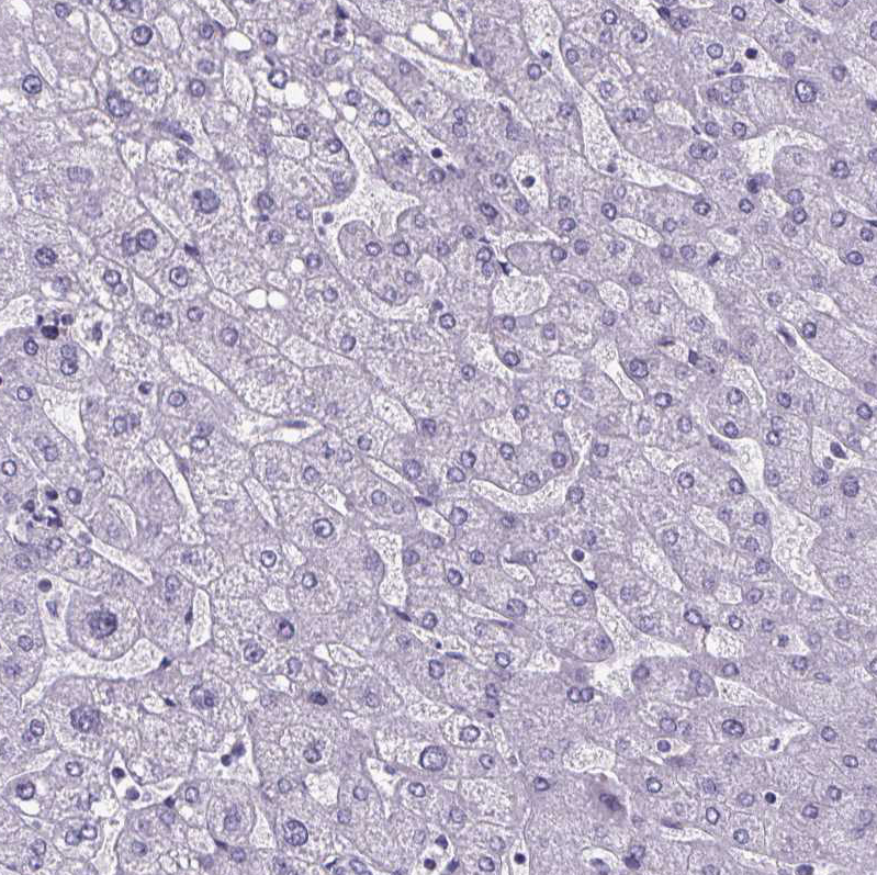 Immunohistochemistry (Formalin/PFA-fixed paraffin-embedded sections) - Anti-Cubilin antibody (AB244274), expandable thumbnail