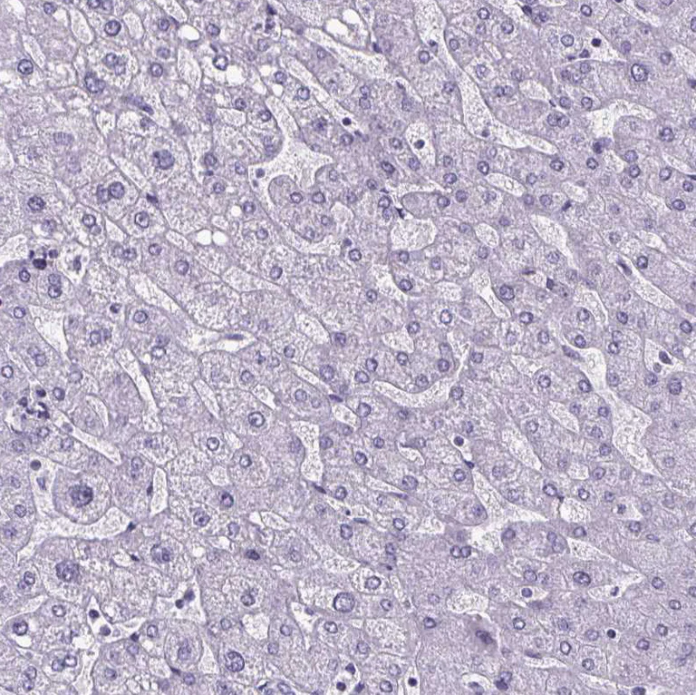 Immunohistochemistry (Formalin/PFA-fixed paraffin-embedded sections) - Anti-Cubilin antibody (AB244274)