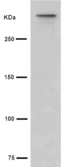 Western blot - Anti-Cubilin antibody [EPR16259-34] - C-terminal (AB191074), expandable thumbnail