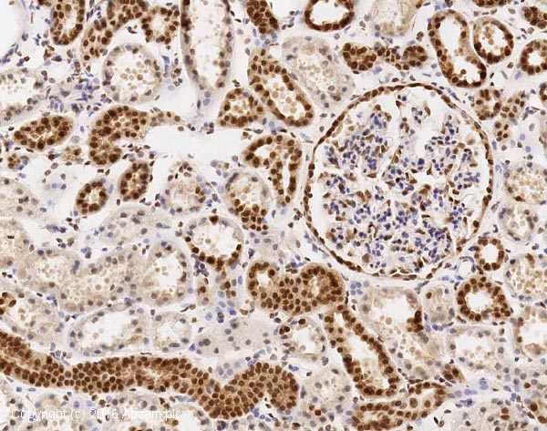 Immunohistochemistry (Formalin/PFA-fixed paraffin-embedded sections) - Anti-CUG-BP1 antibody [3B1] (AB9549)