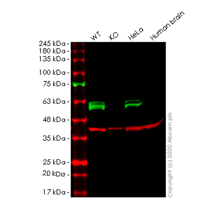 Western blot - Anti-CUG-BP1 antibody [EPR8298(B)] (AB129115)