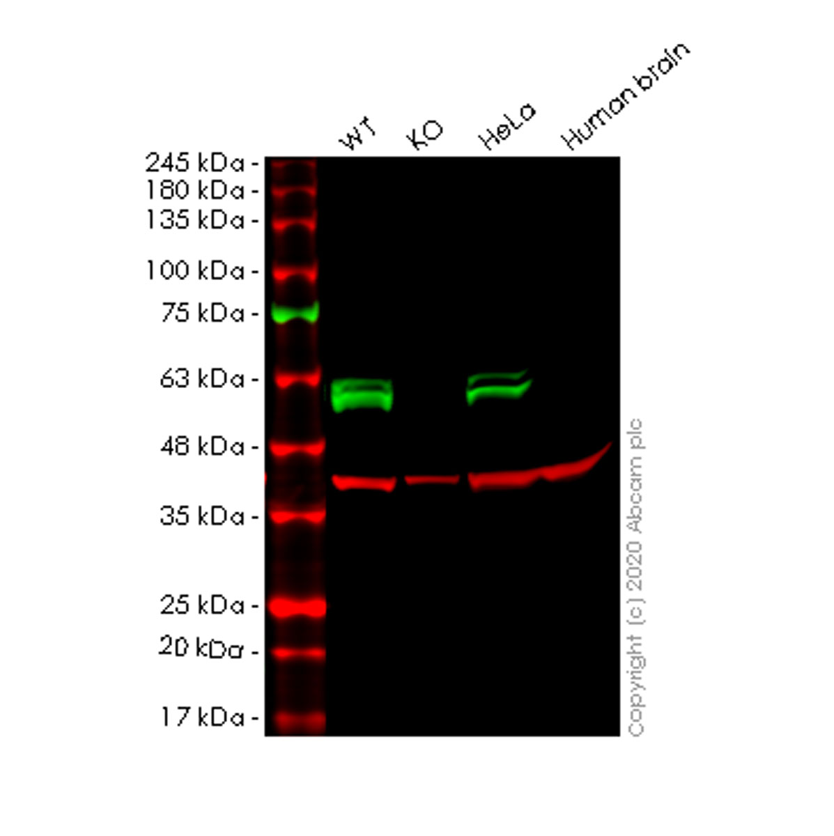 Western blot - Anti-CUG-BP1 antibody [EPR8298(B)] - BSA and Azide free (AB240044)
