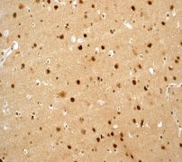 Immunohistochemistry (Formalin/PFA-fixed paraffin-embedded sections) - Anti-CUL-4A + CUL-4B antibody [EPR3200] (AB76470)