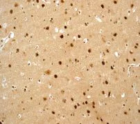 Immunohistochemistry (Formalin/PFA-fixed paraffin-embedded sections) - Anti-CUL-4A + CUL-4B antibody [EPR3200] (AB76470)