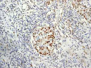Immunohistochemistry (Formalin/PFA-fixed paraffin-embedded sections) - Anti-Cullin 1/CUL-1 antibody [EPR3103Y] (AB75817)