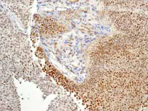 Immunohistochemistry (Formalin/PFA-fixed paraffin-embedded sections) - Anti-Cullin 1/CUL-1 antibody [EPR3103Y] - BSA and Azide free (AB202555)