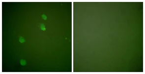 Immunocytochemistry/ Immunofluorescence - Anti-Cullin 2/CUL-2 antibody (AB133180)