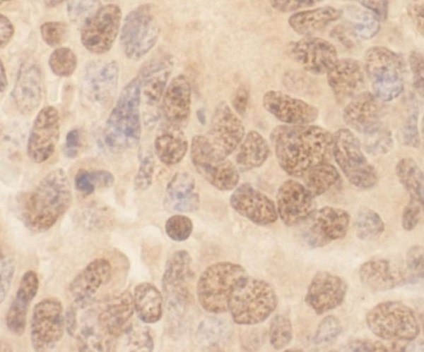 Immunohistochemistry (Formalin/PFA-fixed paraffin-embedded sections) - Anti-Cullin 2/CUL-2 antibody (AB226463), expandable thumbnail