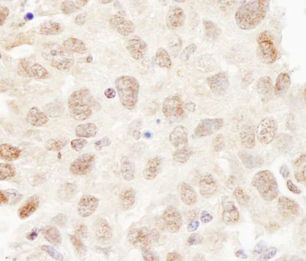 Immunohistochemistry (Formalin/PFA-fixed paraffin-embedded sections) - Anti-Cullin 3/CUL-3 antibody (AB245410)