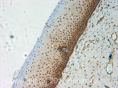 Immunohistochemistry (Formalin/PFA-fixed paraffin-embedded sections) - Anti-Cullin 4A/CUL-4A antibody (AB72548)