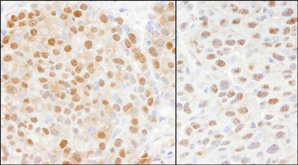 Immunohistochemistry (Formalin/PFA-fixed paraffin-embedded sections) - Anti-Cullin 4A/CUL-4A antibody (AB72548)