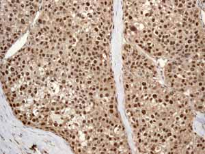 Immunohistochemistry (Formalin/PFA-fixed paraffin-embedded sections) - Anti-Cullin 4A/CUL-4A antibody [EPR3198] - BSA and Azide free (AB247585), expandable thumbnail
