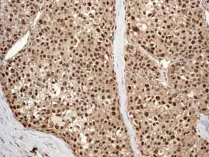 Immunohistochemistry (Formalin/PFA-fixed paraffin-embedded sections) - Anti-Cullin 4A/CUL-4A antibody [EPR3198] - BSA and Azide free (AB247585)